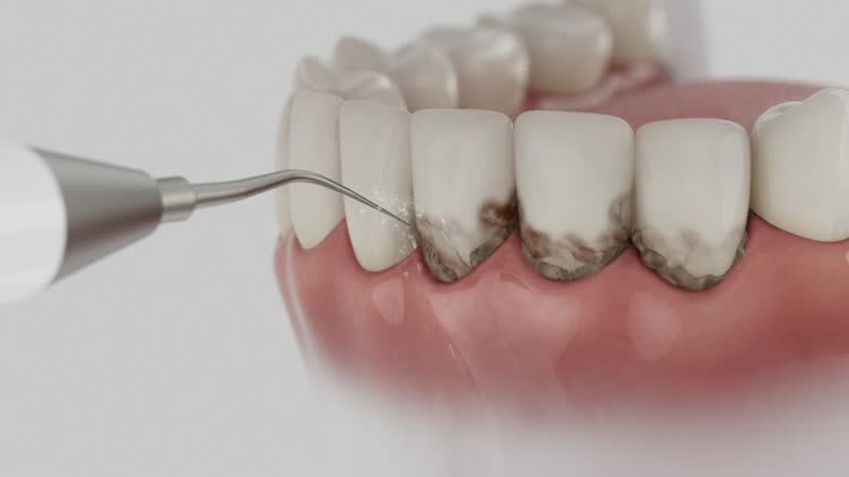 Reliable Dental Implants contractor in Auburn, IL by Smile Center Dentistry